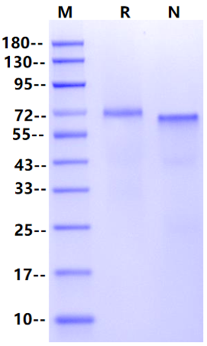 NOTCH1 His Tag Protein, Human