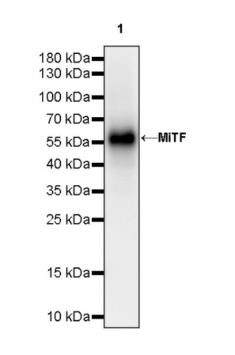 MiTF Recombinant Rabbit mAb (S-1047-50)