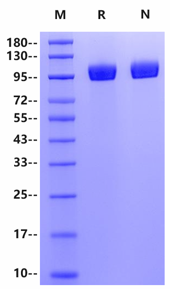 DPP4/CD26 His Tag Protein, Cynomolgus