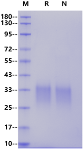TMIGD2/CD28H His Tag Protein, Human