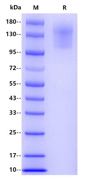 Human CD45, His tag