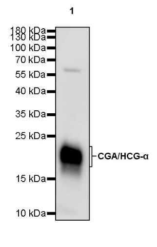 S-RMab® CGA/HCG-α Recombinant Rabbit mAb (SDT-643-61)
