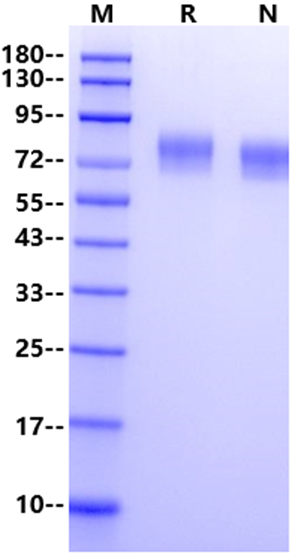 VNN1/Vanin-1 His Tag Protein, Human