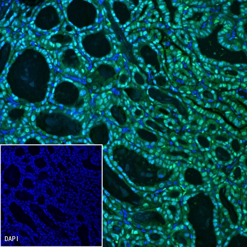 TTF-1 Recombinant Rabbit mAb (Alexa Fluor® 488 Conjugate) (SDT-R097)