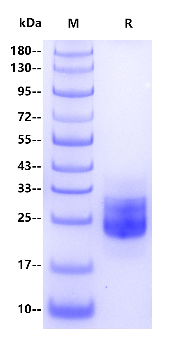Monkeypox virus M1R, His Tag