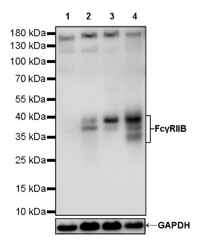 FcγRIIB Recombinant Rabbit mAb (S-R335)
