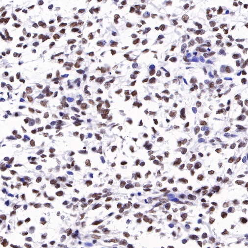 S-RMab® ATRX Recombinant Rabbit mAb (SDT-458-37)