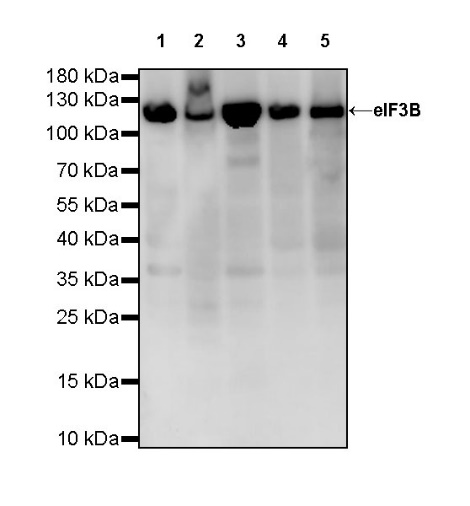 eIF3B Recombinant Rabbit mAb (S-816-8)