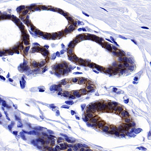 ErbB3 Recombinant Rabbit mAb (SDT-991-73-2)