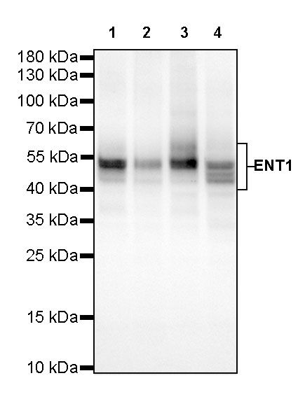 ENT1 Recombinant Rabbit mAb (SDT-R182)