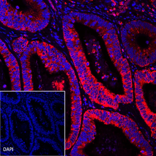 AMACR/p504s Recombinant Rabbit mAb (Alexa Fluor® 555 Conjugate) (SDT-401-29)