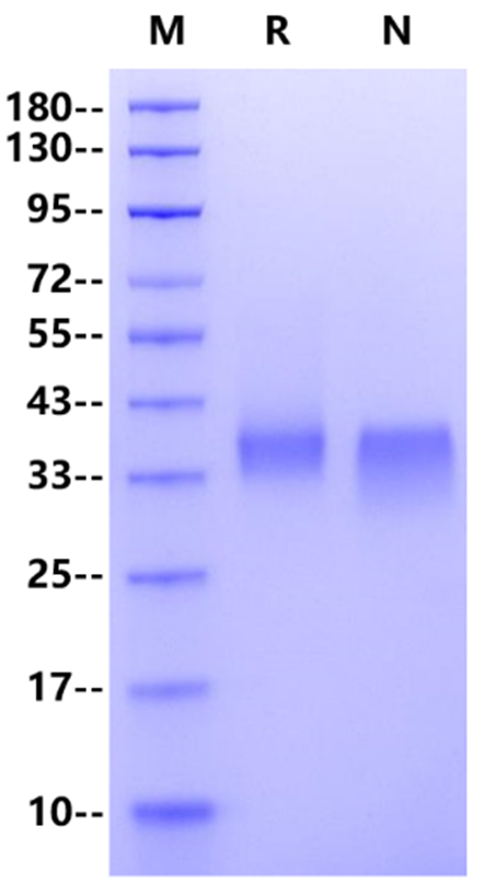 GPA33 His Tag Protein, Human