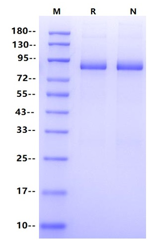 GAD2 His&GST Tag Protein, Human