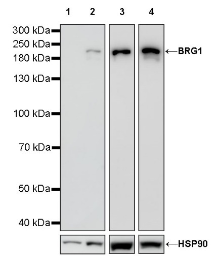 BRG1 Recombinant Rabbit mAb (S-1513-4)