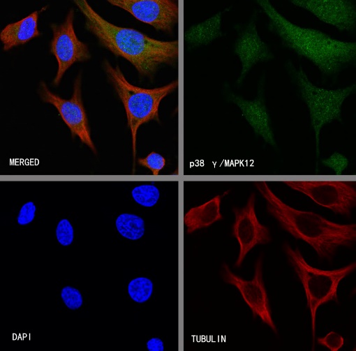 p38 gamma/MAPK12 Recombinant Rabbit mAb (S-1253-50)