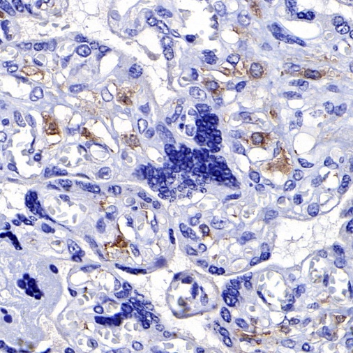CSF-1R Recombinant Rabbit mAb (S-467-26)