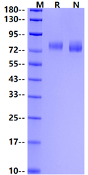 H1N1 HA1 (A/California/04/2009) His Tag Protein
