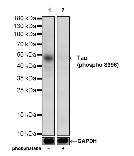 Tau (phospho S396) Recombinant Rabbit mAb (S-R276)