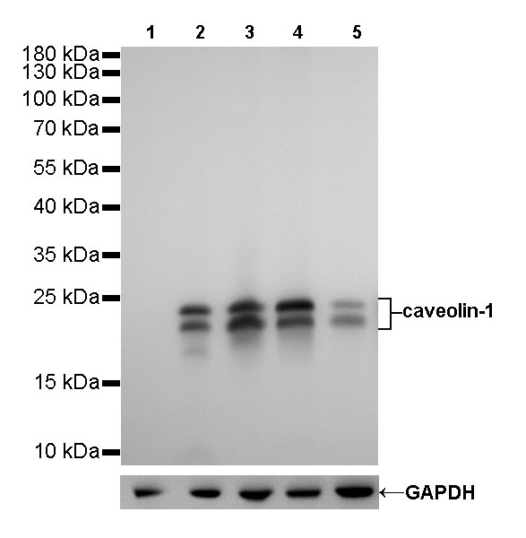 Caveolin-1 Recombinant Rabbit mAb (SDT-065-20)