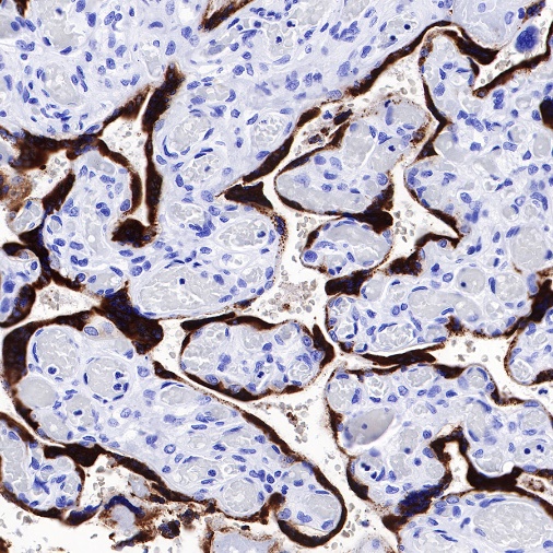 Placental lactogen Recombinant Rabbit mAb (S-454-142)