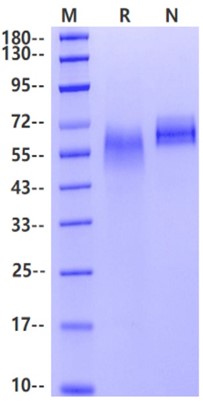 DLL-4 His Tag Protein, Human