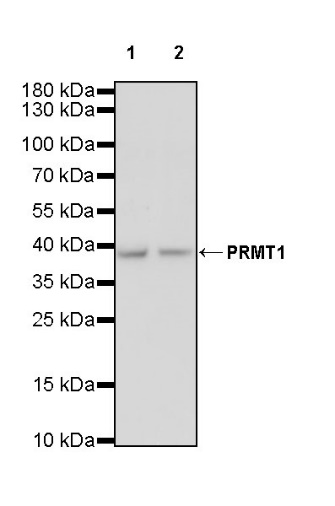 PRMT1 Recombinant Rabbit mAb (S-884-10)