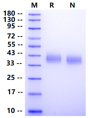 Biotinylated LILRA5/CD85f/ILT11 His&Avi Tag Protein, Human