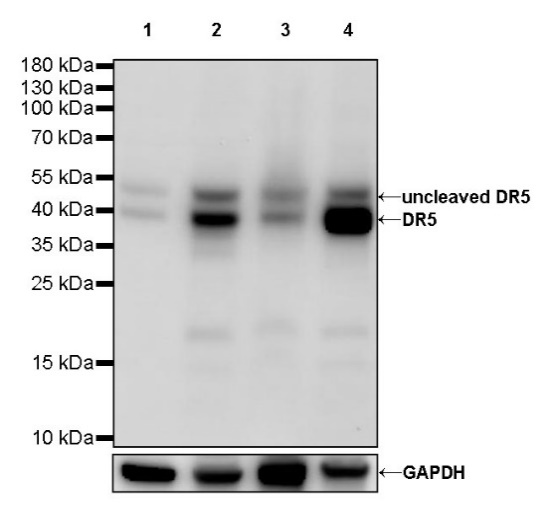 DR5 Recombinant Rabbit mAb (S-649-36)