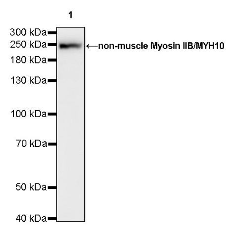 Non-muscle Myosin IIB/MYH10 Recombinant Rabbit mAb (S-299-3)