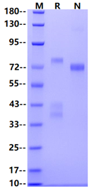 RON/CD136 His Tag Protein, Human