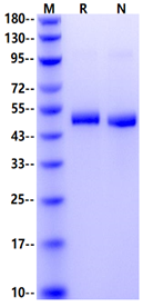 RENIN His Tag Protein, Human