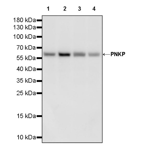 PNKP Rabbit Polyclonal Antibody