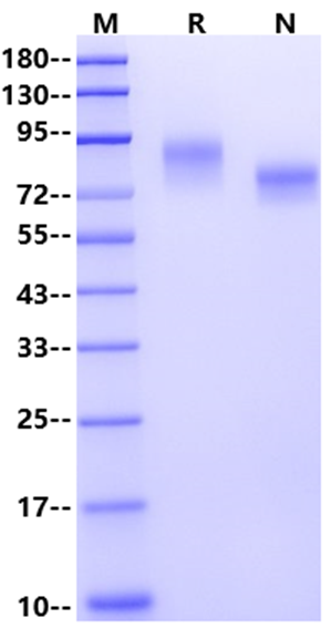 E-Selectin/CD62E His Tag Protein, Human