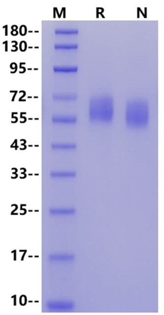 IL1RL1/ST2 (isoform A) His Tag Protein, Human