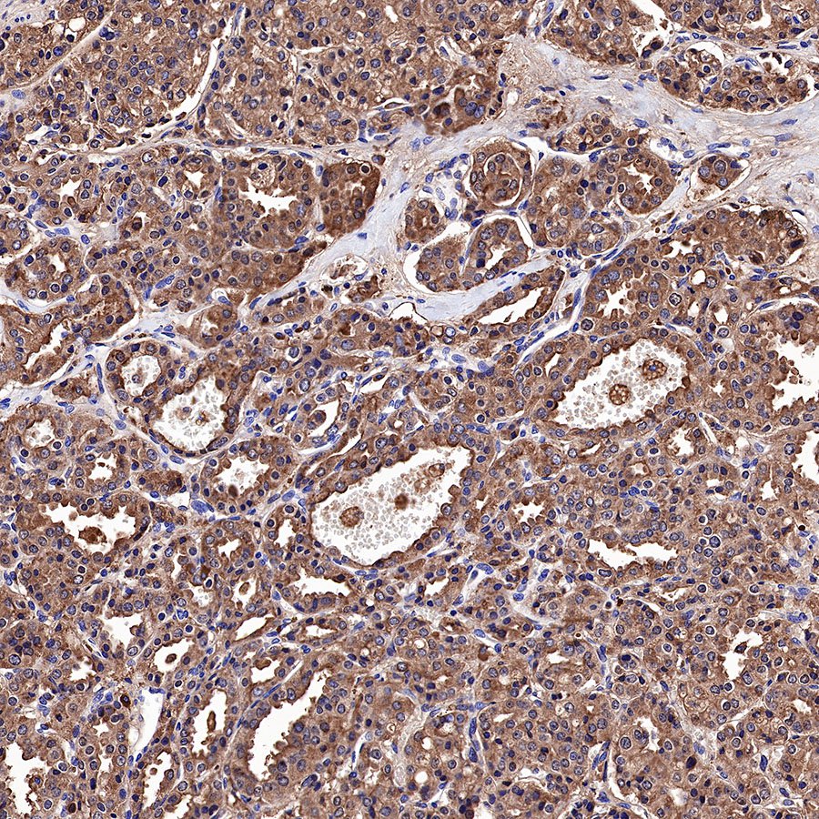 S-RMab® PSA Recombinant Rabbit mAb (SDT-195-14)