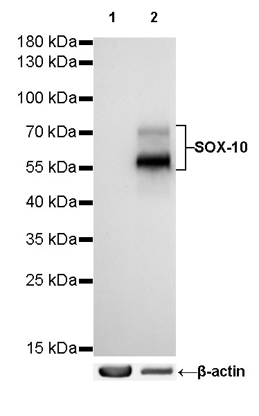 SOX10 Recombinant Rabbit mAb (SDT-136-59)