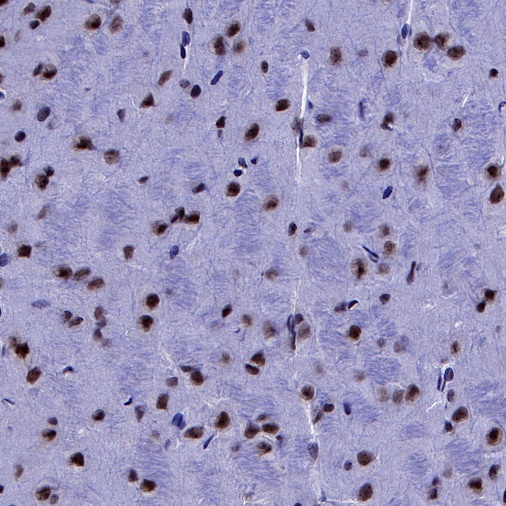 p27 Recombinant Rabbit mAb (S-141-135)