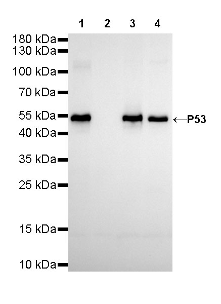 S-RMab® p53 Recombinant Rabbit mAb (SDT-R118)