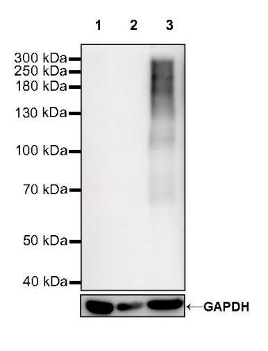 CA125 Recombinant Rabbit mAb (SDT-555-41)
