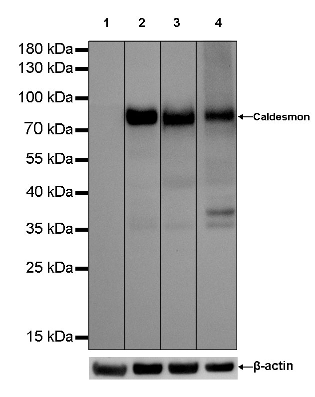 Caldesmon Recombinant Rabbit mAb (SDT-056-48)