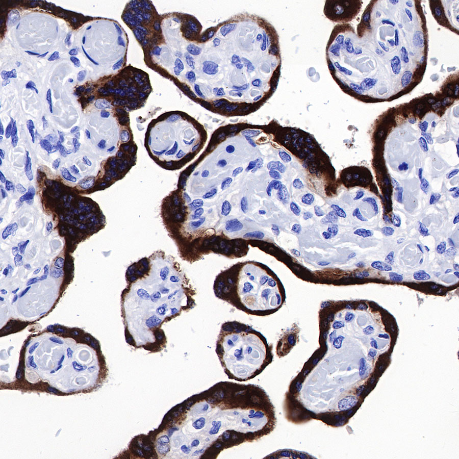 CGB/HCG-β Recombinant Rabbit mAb (SDT-228-46)