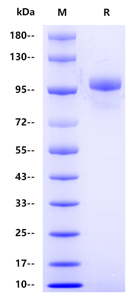 Human Thyroid peroxidase, His tag