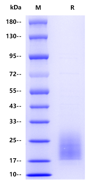 Human CD3 delta, His tag 