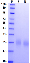 BMPRIA/ALK-3 His Tag Protein, Human