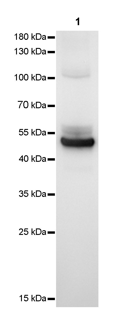 S-RMab® Keratin 14 Recombinant Rabbit mAb (SDT-023-12)