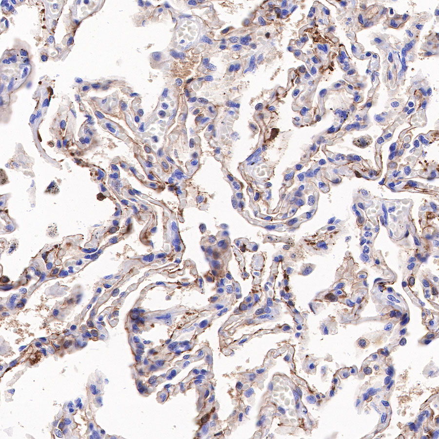 Claudin18.2 + Claudin18.1 Recombinant Rabbit mAb (SDT-298-29)