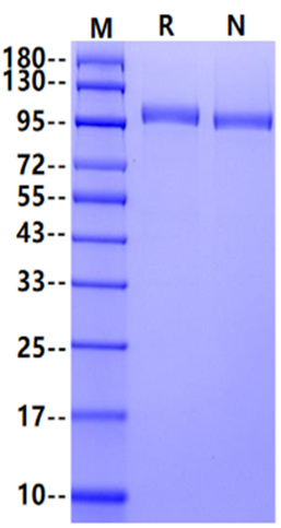 CDH17/LI-cadherin His Tag Protein, Cynomolgus