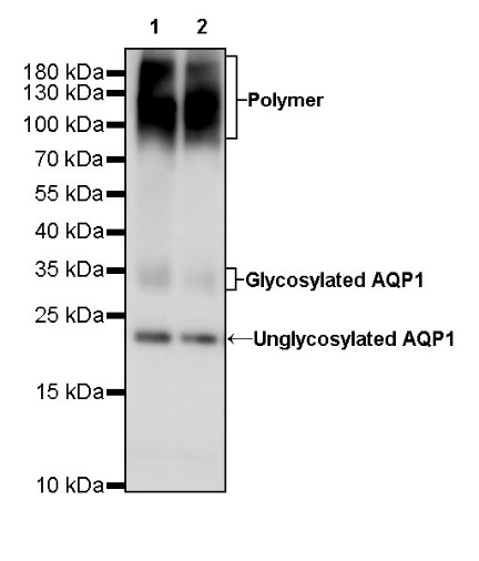 Aquaporin 1/AQP1 Recombinant Rabbit mAb (S-794-79)