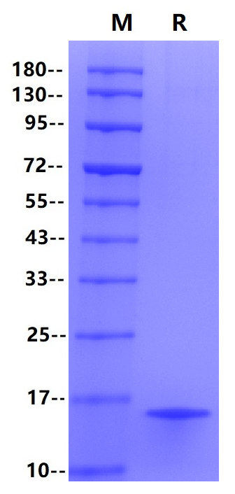 Procalcitonin (PCT) His Tag, Human