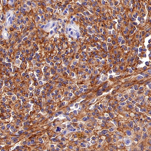 Claudin 5 Recombinant Rabbit mAb (SDT-R322)